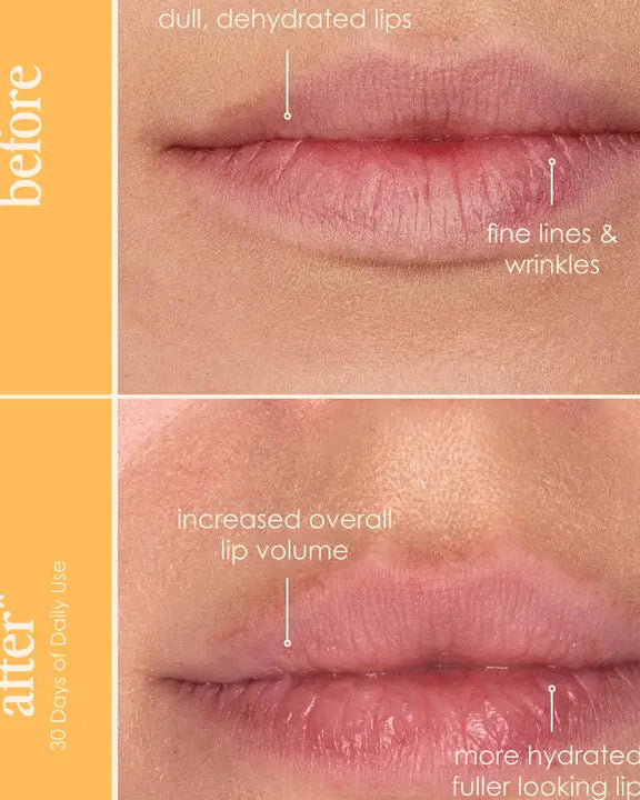 GrandeLIPS Hydrating Lip Plumper | Instant Fuller-Looking Lips